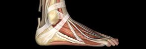 Achilles Tendon Pain