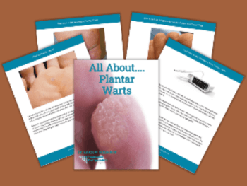 Houston Plantar Wart Specialist | Free E-book